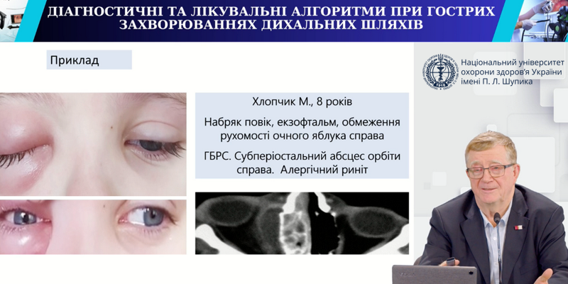 Актуальні питання дитячої оториноларингології в педіатрії та сімейній медицині